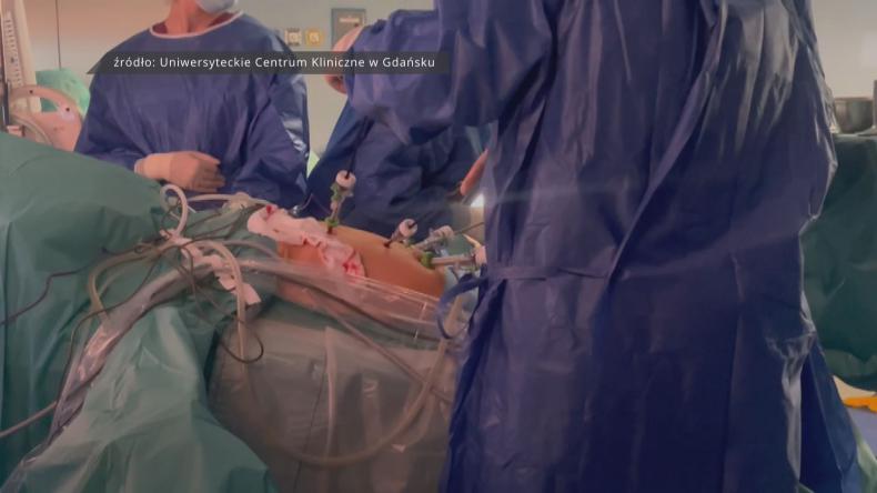 Małoinwazyjne operacje trzustki w UCK