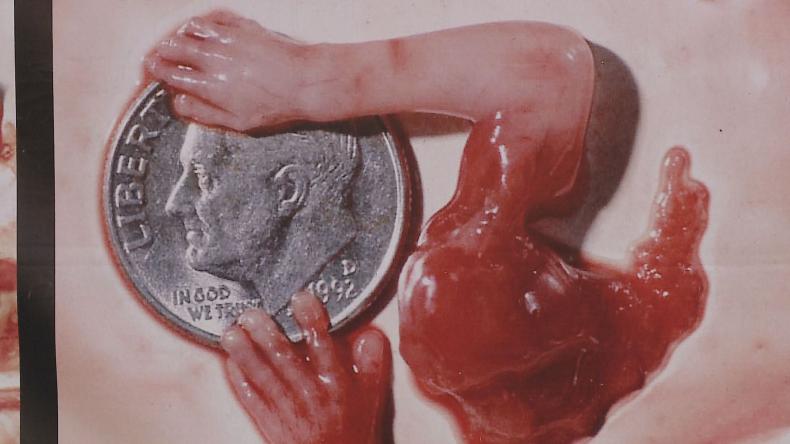 Szokujące zdjęcia przed kościołem